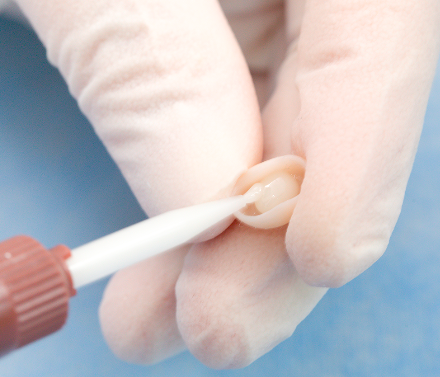 TopCEM Dual Cure Resin Cement
