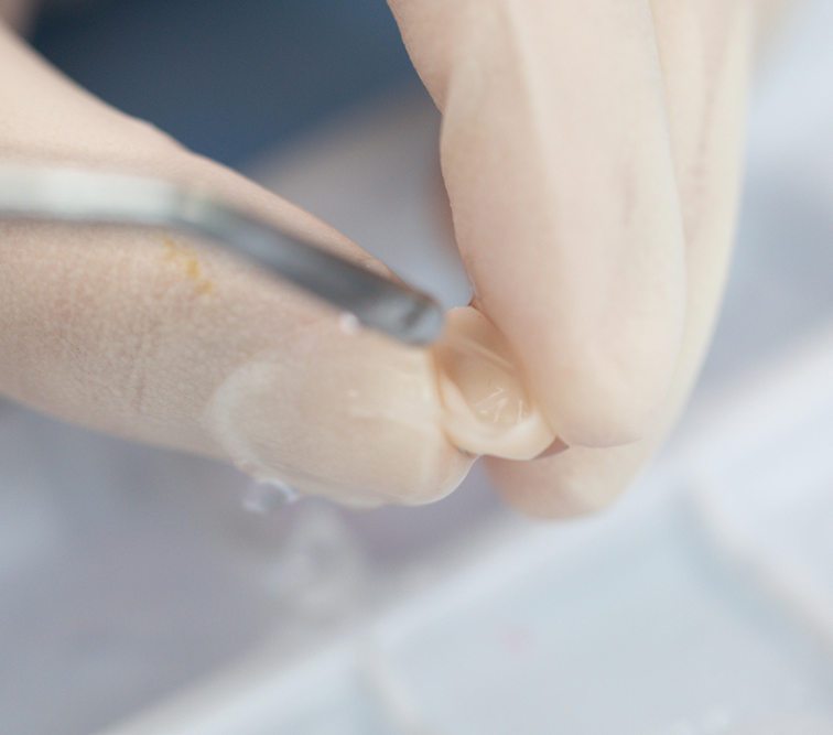 HF-Etchant Hydrofluoric Acid Etching Gel