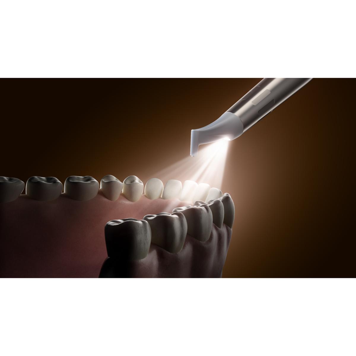 Woodpecker® PT-E Air Polisher & Ultrasonic Scaler
