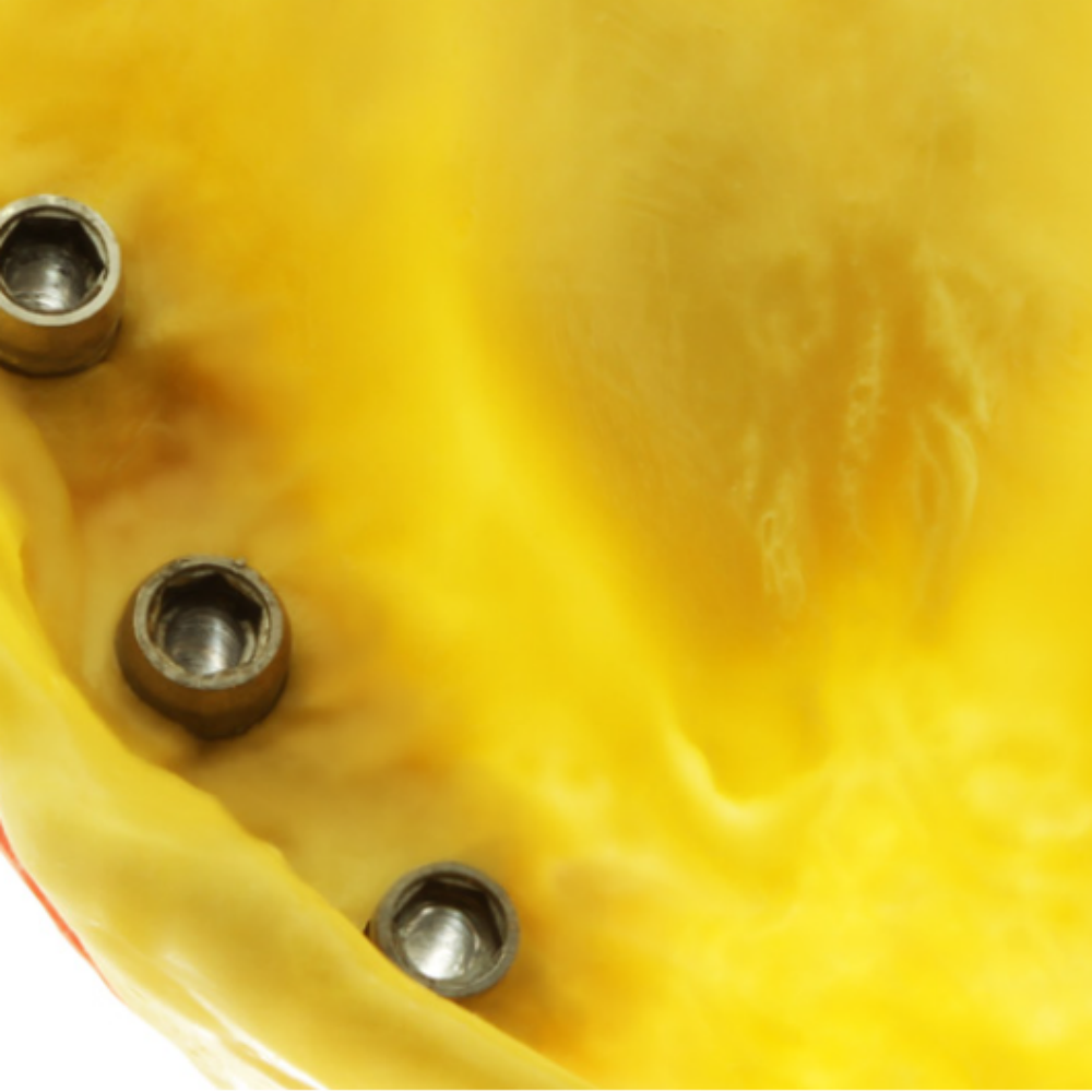 PERFIT Monophase
