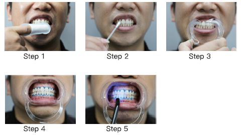 how to do teeth whitening