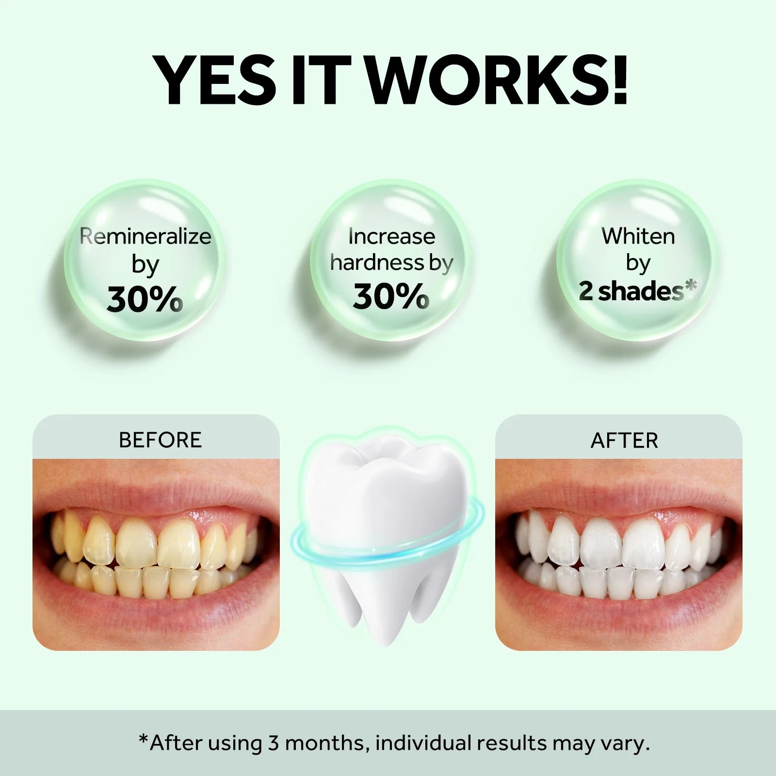 MySmile® Nano-Hydroxyapatite Toothpaste