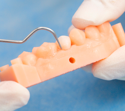 TopCEM Dual Cure Resin Cement