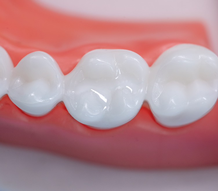 Proseal F Enamel Coating Resin