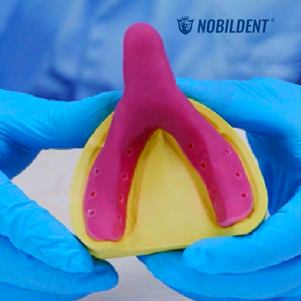 NOBILCURE Light Curing Unit