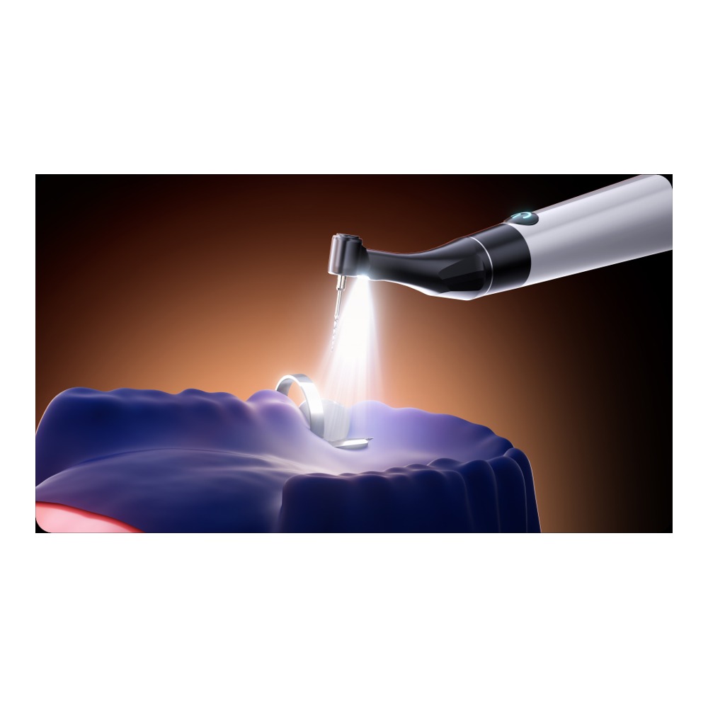 Woodpecker® Endo GT Pro Endo Motor with Built-In Apex Locator, LED Contra-Angle, Up to 3000 RPM